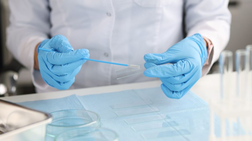 Test del VPH clave en la prevención del cáncer de cuello uterino